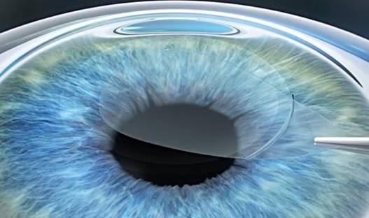 深挖｜高考生都向往的“全飞秒”，神奇之处在哪里？