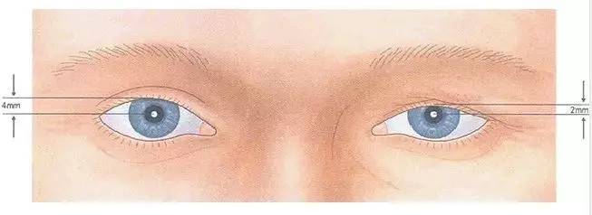 关关变身成美女,关关拿掉眼睛