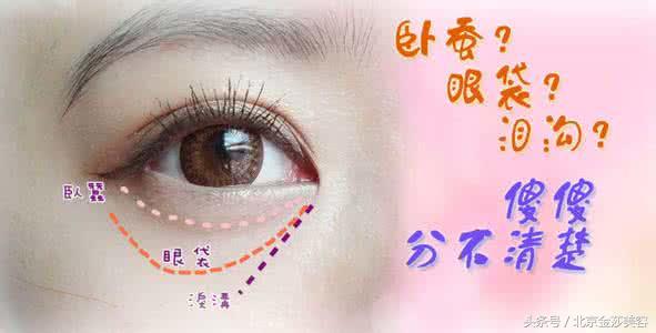 泪沟和眼袋有什么区别？预防及治疗方法有哪些？