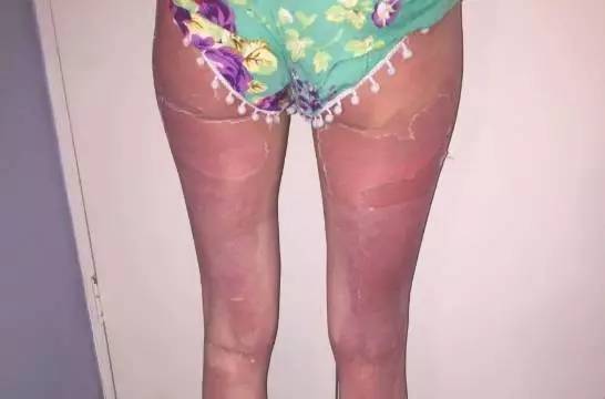 进藏最好用的防晒推荐一下,进藏必买的防晒乳有哪些