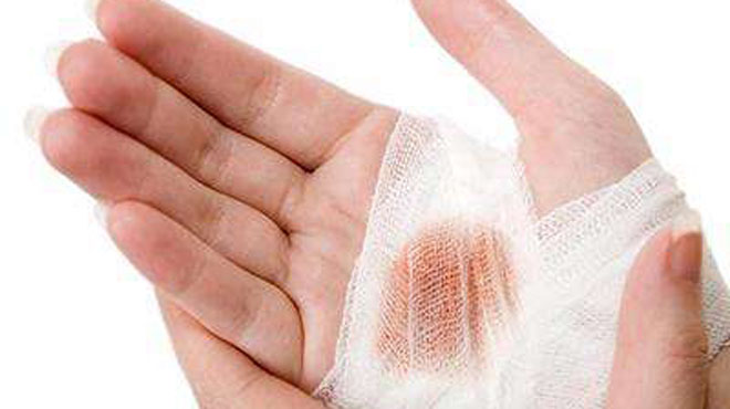 肝部位长红痣是什么原因不痛不痒,身上长红痣是肝出现问题了吗