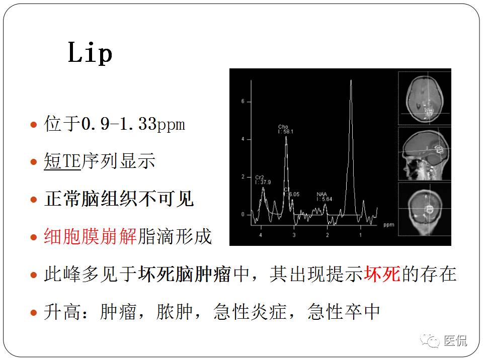 神经系统解剖ppt课件,神经内科课件ppt