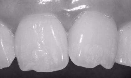 一把瓜子一勺油,一口瓜子满口油是真是假