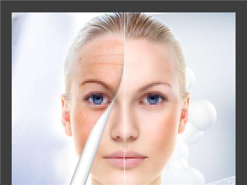 脸上的皱纹怎么去掉最好方法,脸上的皱纹怎么去除最简单的方法