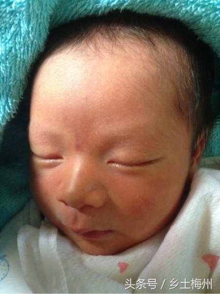 小孩长痱子能用艾草水洗吗,一岁宝宝长痱子能够洗十滴水吗