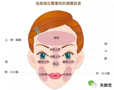 长痘位置决定了清痘方式，恐怕你还不知道吧！