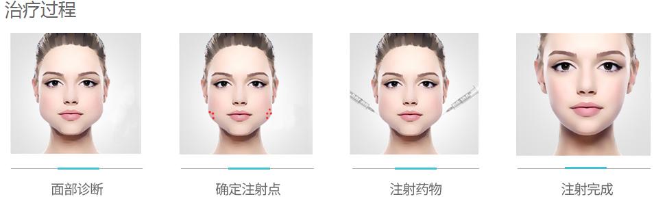 打完瘦脸针后悔了有什么办法,打完瘦脸针后悔了咋办