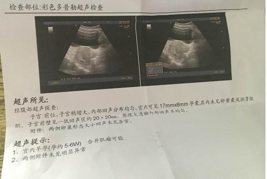 忽然出现胎停是什么原因,忽然出现胎停是怎么回事