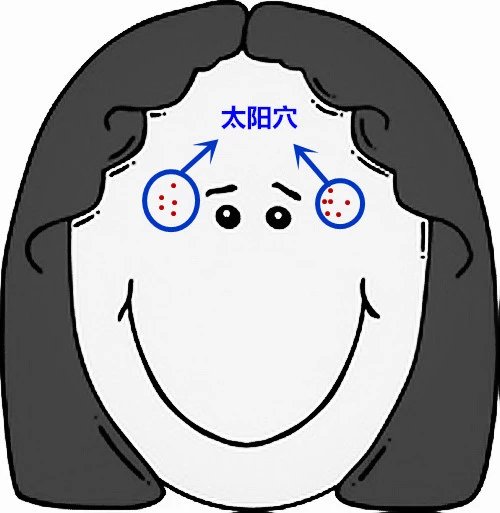 脸部痘痘看身体状况,超全面面部痘痘分析图文