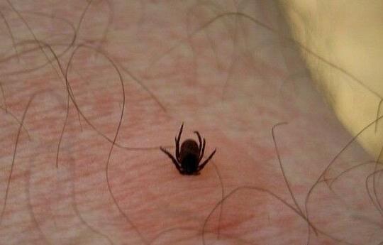 宝宝头上疙瘩说是过敏,宝宝头上起了小疹子是过敏吗