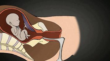 堕胎手术有多可怕,做了堕胎手术