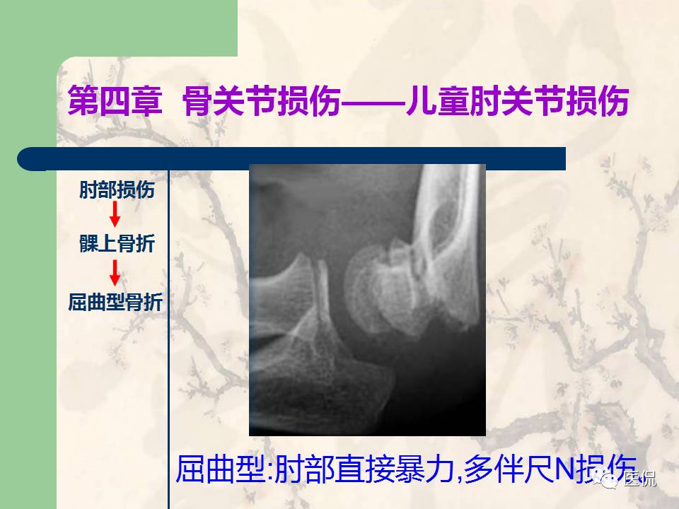 骨关节创伤x线诊断图谱,骨关节损伤x线图