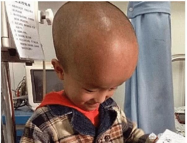 2003年大头娃娃假奶粉事件,大头娃娃假奶粉事件