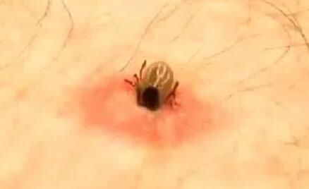 宝宝头上疙瘩说是过敏,宝宝头上起了小疹子是过敏吗