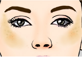 激光祛痣和激光祛斑选择模式,激光洗眉和激光祛斑是一样的吗