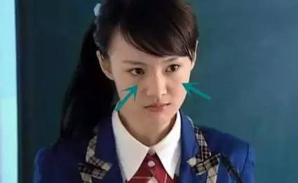 郑爽泪沟、眼袋明显到糊住镜头，学生*党**们的通病该怎么治？