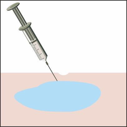 郑爽泪沟、眼袋明显到糊住镜头，学生*党**们的通病该怎么治？
