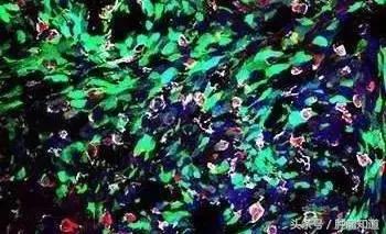 喝咖啡能防肝硬化？吓得我又多喝了一口！