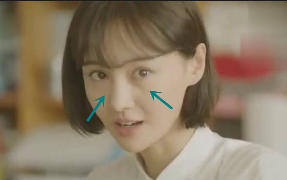 郑爽泪沟、眼袋明显到糊住镜头，学生*党**们的通病该怎么治？