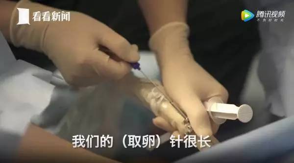 捐卵，被明码标价的青春｜关于捐卵应该知道的科普