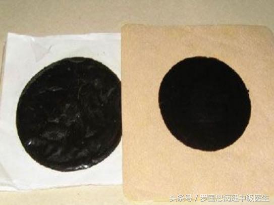 舒筋活络膏骨折能够用嘛,舒筋活络膏骨折