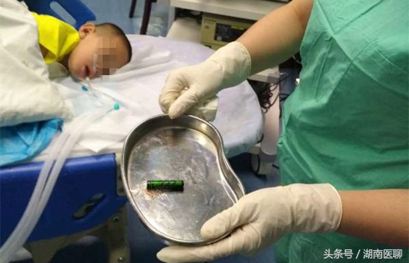 小孩胃溃疡出血好久恢复正常,十岁孩子胃粘膜糜烂