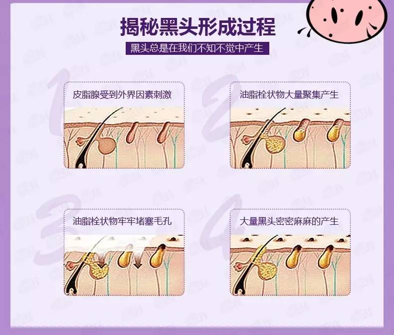 “黑头”这个渣男，彻底和他Say byebye~