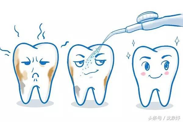 每天刷牙牙齿还黄？学会这些是美白牙齿的要害