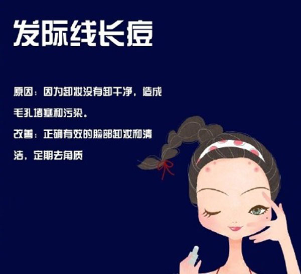 鼻子下边嘴唇上边长痘是什么原因,鼻翼两侧和下巴长痘什么原因引起