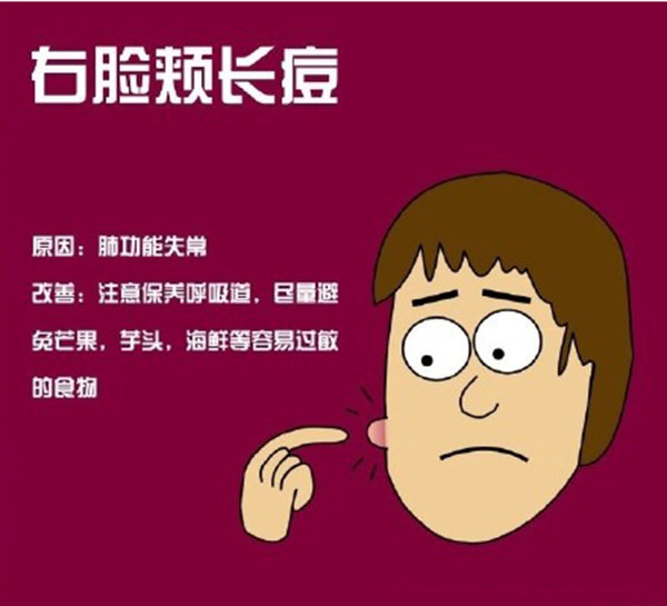 鼻子下边嘴唇上边长痘是什么原因,鼻翼两侧和下巴长痘什么原因引起