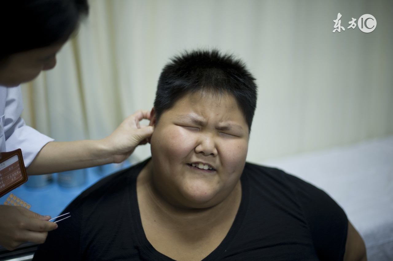 激素依赖性皮炎能够打针来治疗吗,激素脸口服皮肤抗炎药还会反复吗