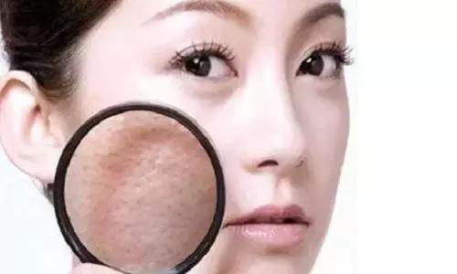 点阵激光能够解决皮肤老化吗,激光点阵和射频