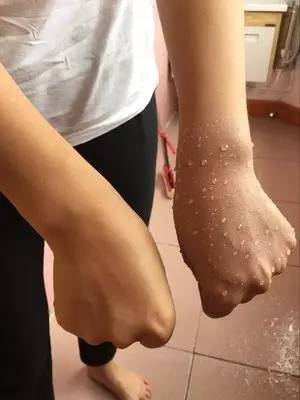 周一团丨错过无，夏季防晒+驱蚊收官之团，价格超！级！劲！爆！