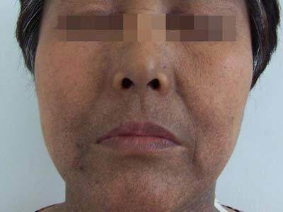 为什么洗面奶用了感觉脸变黑了,为什么自从用了洗面奶过后变黑了