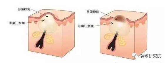 快速让皮肤变水嫩的方法,用鸡蛋怎么让皮肤水嫩嫩的