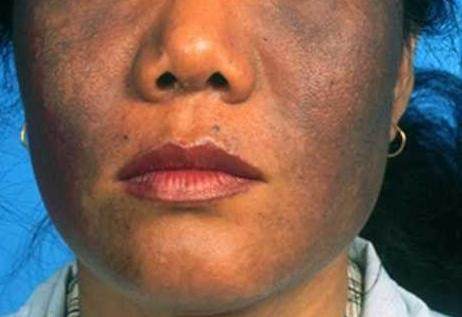 为什么洗面奶用了感觉脸变黑了,为什么自从用了洗面奶过后变黑了