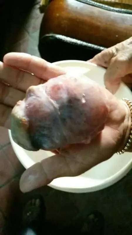 晋江永和阿婆杀鸡时发现一块“宝”!检测费3000舍不得呀~