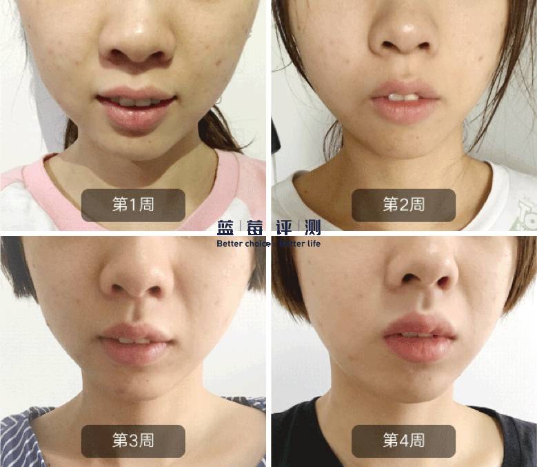 十大公认最好的美容仪,目前最好的美容仪是哪种