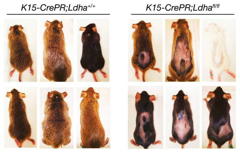 自然脱发会再生吗,自然疗法治脱发