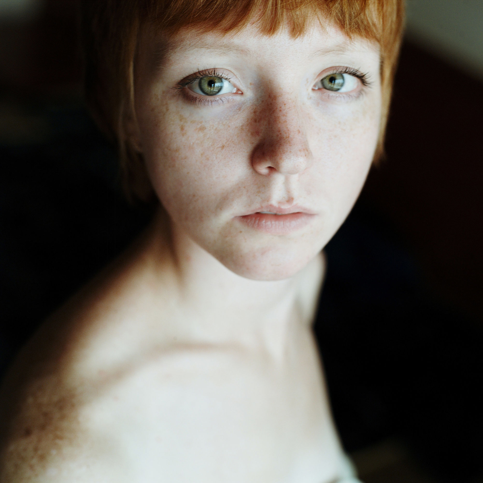 晒黑的黑色素怎么才能淡化,晒黑了去除黑色素就能白吗