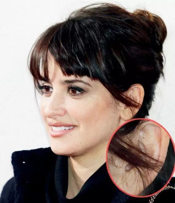 精品话题｜拔罐、针灸，你们的idol“好这口”！