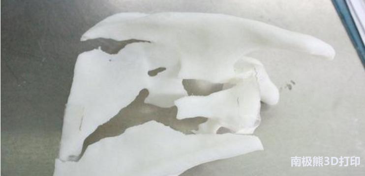 3d打印医学骨科模型,骨折3d打印合适哪些手术