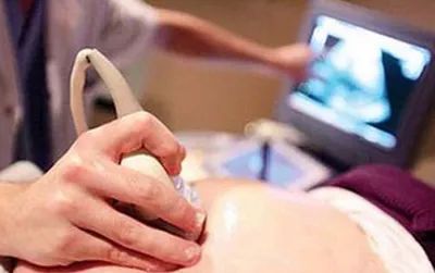 「女性健康」妇科B超检查二三问
