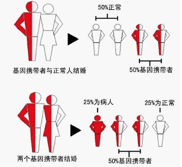 怀孕期间有地中海贫血症状和危害,怀孕地中海贫血对胎儿有什么影响