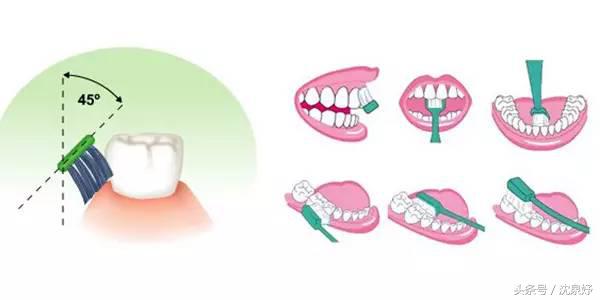 每天刷牙牙齿还黄？学会这些是美白牙齿的要害