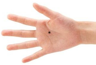 痣相看你是否旺夫,痣相看人