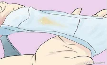 月经快来白带有血丝肚子隐隐的痛,白带有血是要来姨妈了吗