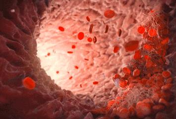 心梗直播间,心梗发病全过程视频