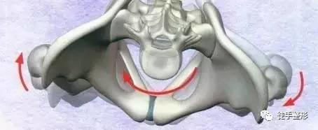 徒手整形许强分享：原来骨盆不正对女性影响这么大