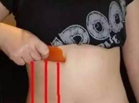 强力燃脂减肚子赘肉，只需每天刮2下，就能让你轻松拥有迷人马甲线！